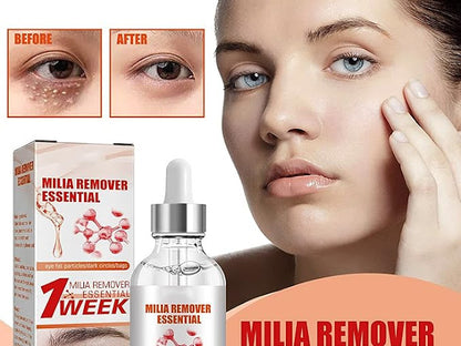 Smooth Milia Remover Serum (30ml)