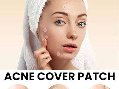 Acne Cover Patch (72pc)