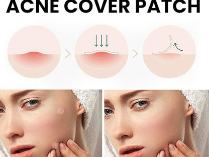 Acne Cover Patch (72pc)