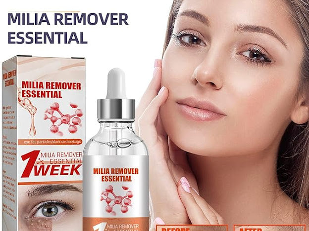 Smooth Milia Remover Serum (30ml)