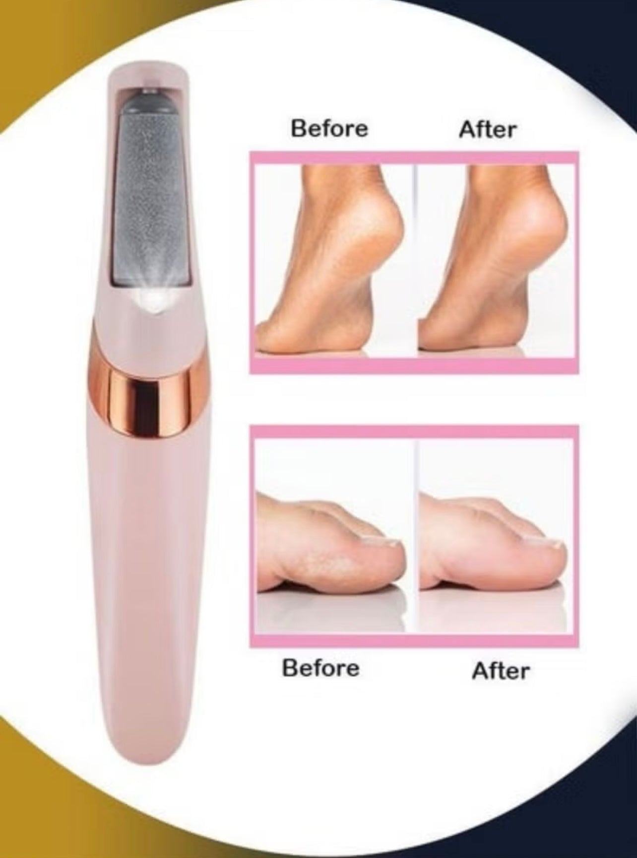 Electric Pedicure Foot File Callus Remover