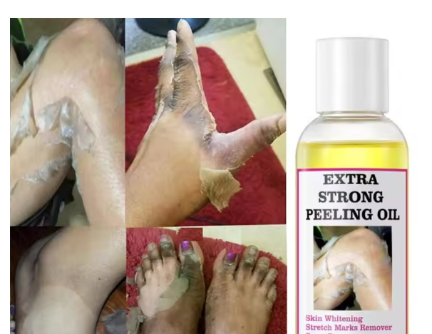 Peeling Oil (110ml)