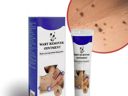 Warts Remover