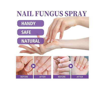 Nail Fungus Spray