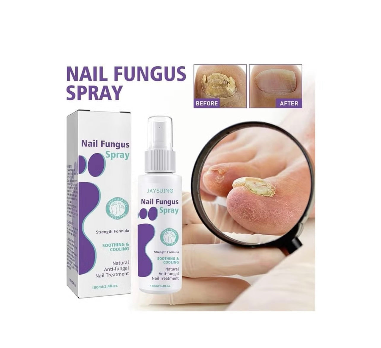 Nail Fungus Spray